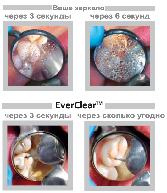 преимущества стоматологического зеркала EverClear